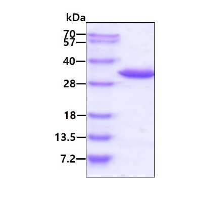 SDS-PAGE: Recombinant Human TRPT1 His Protein [NBP1-78826]